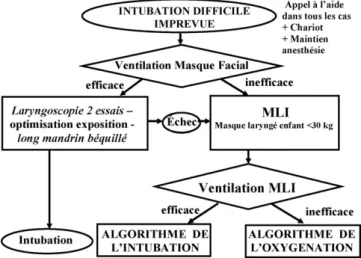 Fig. 2. Algorithme de l’intubation difficile impre´vue.MLI : masque larynge´
