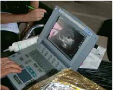 Fig 1 : Echographe Sonosite® Titan.