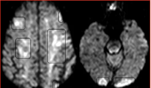 Figure 1. AVC multiples.