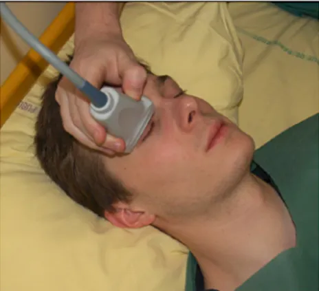 Figure  2  :  Réalisation  de  la  mesure  du  DENO  par  échographie.  La  main  est  appuyée sur le front du patient afin d’éviter  d’exercer  une  pression  excessive  sur  le  globe oculaire.