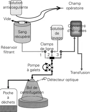 Figure 1 : Cell Saver avec lavage séquentiel d’après [8]