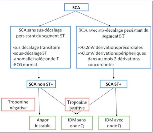 Figure 1 – Classification des syndrômes coronariens aigus