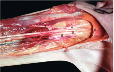 Figure 13. Bloc axillaire. Repères de ponction pour la neurostimulation.