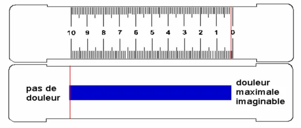Figure 10 : Échelle Visuelle Analogique 