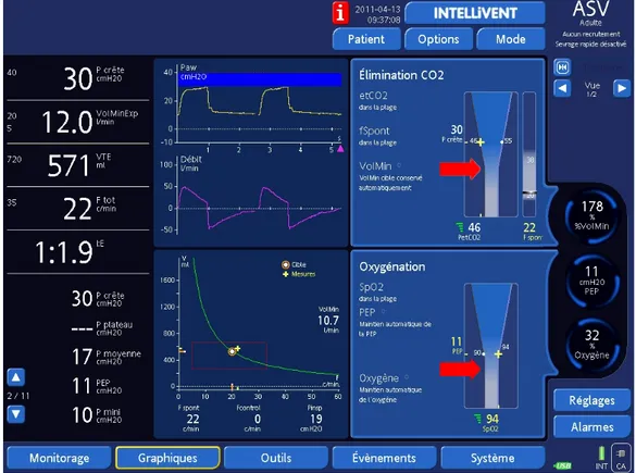Figure 7.- Capture d'écran d'un ventilateur en mode IntelliVent. De haut en bas au milieu, les courbes de  pression des voies aériennes (Paw), de débit en fonction du temps, la courbe de VT en fonction de la  fréquence respiratoire avec le cadre rouge repr