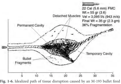 Fig. 1-5. Idealized path of tissue disruption caused by an AK-47 projectile 