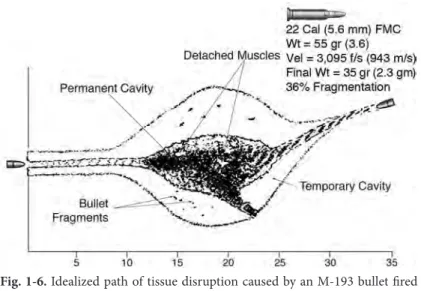 Fig. 1-5. Idealized path of tissue disruption caused by an AK-47 projectile 