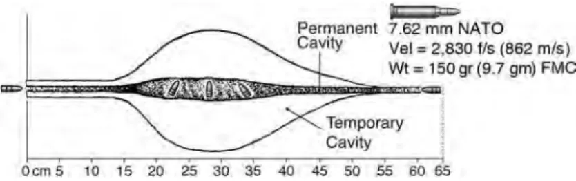 Fig. 1-7. Idealized path of tissue disruption caused by the 7.62-mm projectile 