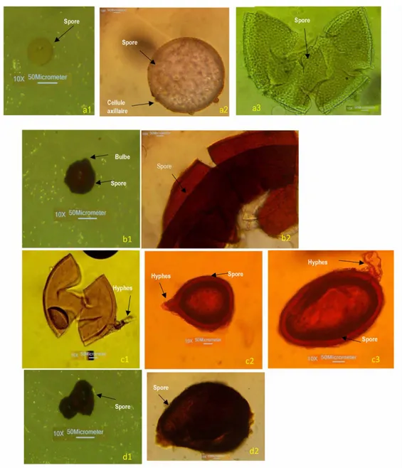 Figure 3: Spores isolées dans les sols prélevés sous le Fromager et le Makoré 