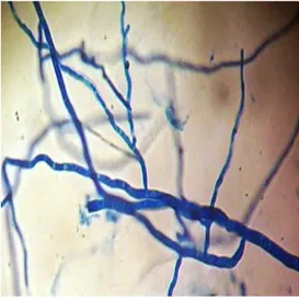 Figure  9 :  Thalle  noirâtre  de  Rhizoctonia  solani isolé sur feuille de PM16/04A (x400) 