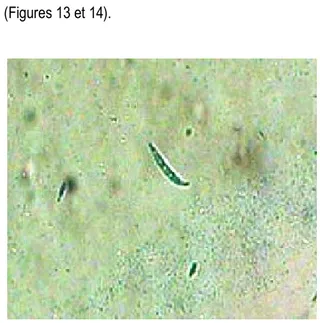 Figure 11 : Thalle blanc laiteux de Fusarium sp  isolé  sur  fruit  de  la  lignée  lignée  PM17/04A  (x400) 