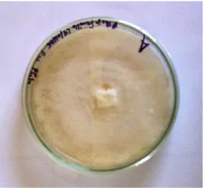 Figure  5 :  Thalle  blanc  cotonneux  de  non  identifié  isolé  sur  les  feuilles  de  PM17/04A  (x400)
