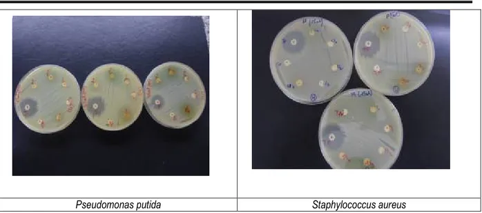 Figure 7 : Test des différents extraits des trois orties sur chacune des quatre souches bactériennes (la seule inhibition  observée est celle des antibiotiques « témoins positifs »)