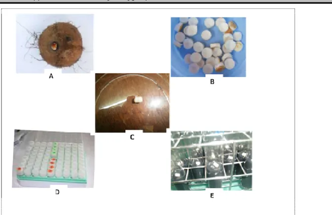 Figure 1 : Différentes étapes de conditionnement de l'embryon zygotique de cocotier 