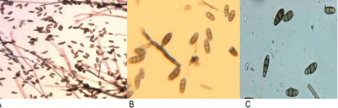 Figure 6:  Microphotograph showing conidial mass of P. grisea with different shapes and size [(45X (A)  and 100X (B and C)].