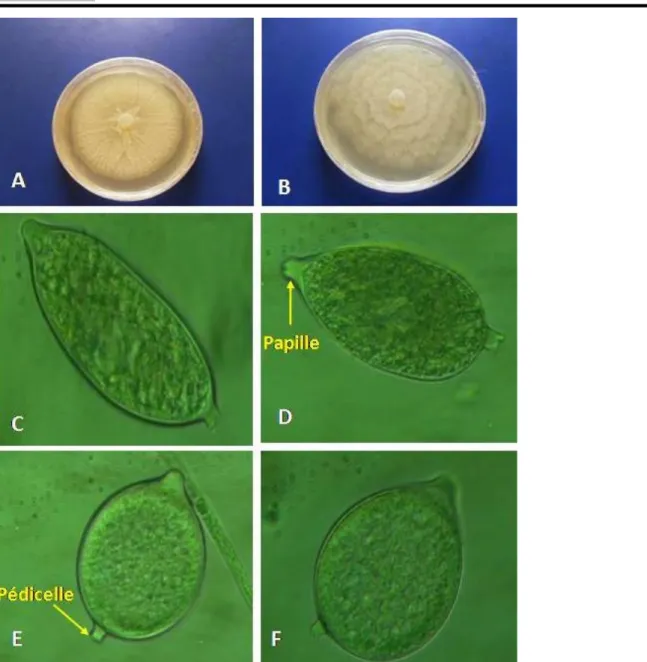 Figure 1 : Caractéristiques morphologiques des isolats de Phytophthora du verger cacaoyers  de Côte d’Ivoire  (grossissement X 400) 