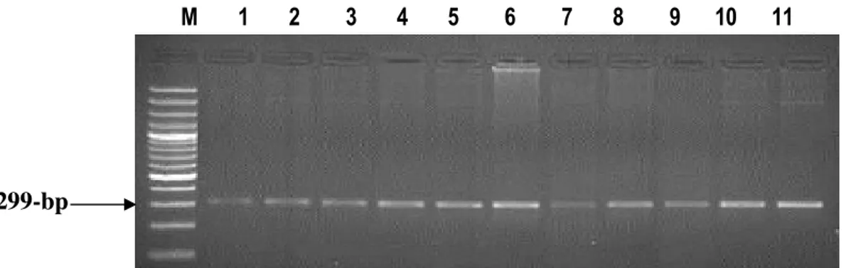 Fig. 1:  Agarose gel stained with ethidium bromide showing the PCR product of β-casein gene   M: 100-bp ladder 