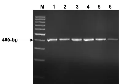 Fig. 4:  Agarose gel stained with ethidium bromide showing the PCR product of K-casein gene