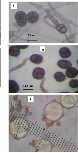 Figure 3. Aspect microscopique des espèces fongiques isolées à partir des fraises. a 1  : conidiophore  et a 2 : conidies 
