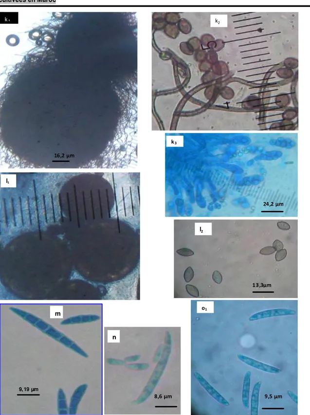 Figure  5.  Aspect  microscopique  des  espèces  fongiques  isolées  à  partir  de  divers  organes  végétatifs  de  Fragaria  ananassa  appartenant à deux variétés « Camarosa » et« Festival »