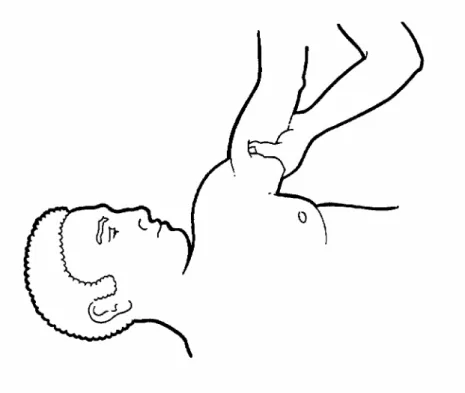 Figure 13 : Point de compression sur la face interne du bras. Point de compression à la base du cou 