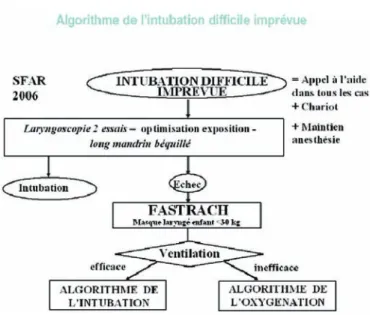 Figure 2. Algorithme de l’intubation difficile imprévue.