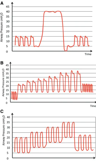 Fig. 4.  Illustrative fluctuation of airway pressure during three 