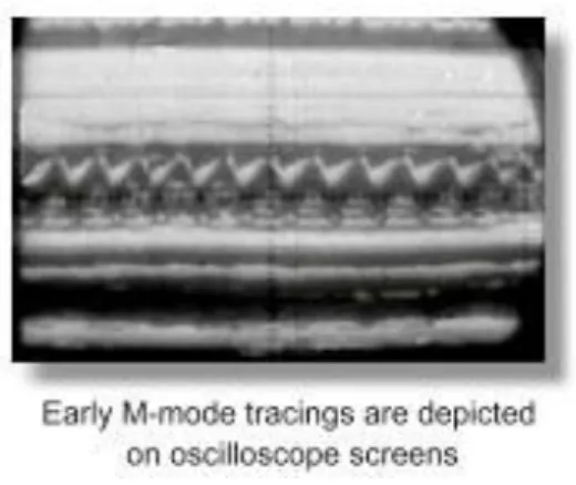 Figure 5 - Mode TM (Temps Mouvement) 
