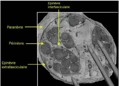 Figure 1: Architecture histologique d’un nerf. Les aiguilles sont ajoutées en surimpression pour  comparer leur taille à celle des fascicules