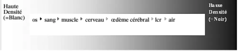 Fig. 1 – Variation de la densité des différentes structures cérébrales, en fonction de l’absorp-