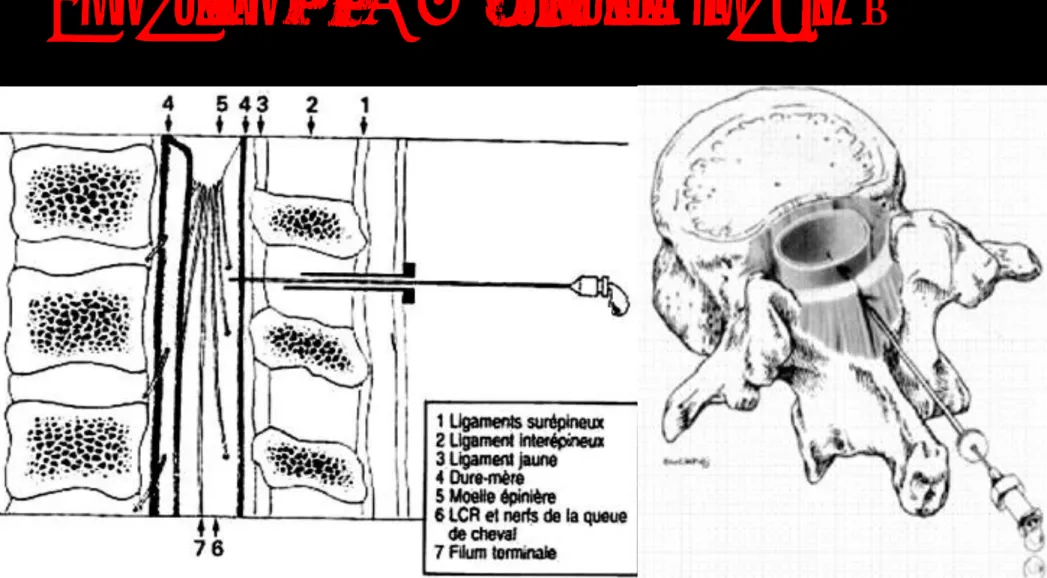 Figure 1 : Rachianesthésie : données anatomiques