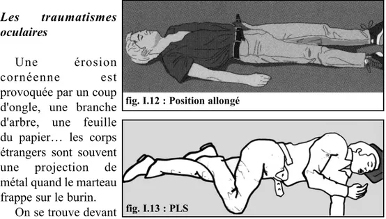 fig. I.13 : PLS