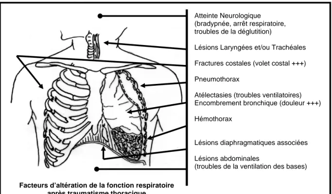Figure 3. Facteurs de dysfonction respiratoire lors de traumatisme thoracique dans le cadre d’un patient  polytraumatisé