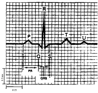 Figure 4 - Enregistrement graphique