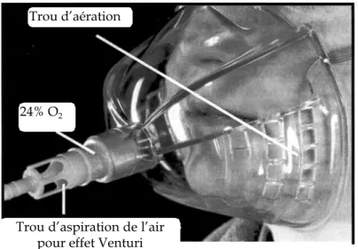 Figure 2 - Masque à concentration réglable et fixe avec le dispositif Venturi d’aspiration de l’air