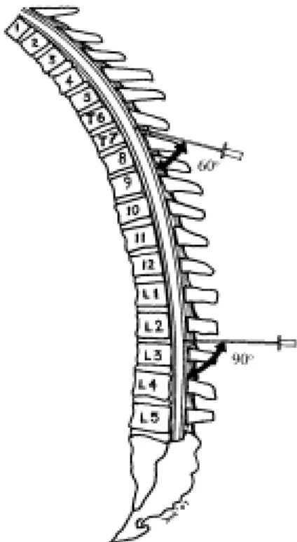 Figure 5. Angulation des apophyses épineuses.