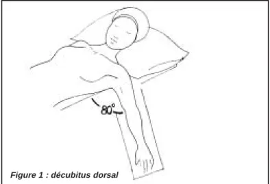 Figure 1 : décubitus dorsal