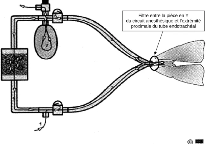 Figure 1.  Schéma du circuit respiratoire avec filtre entre la pièce en Y du circuit 
