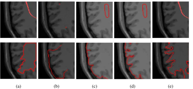 Fig. 4. Comparison of different segmentation results for the white matter and gray matter boundary using different active contour models