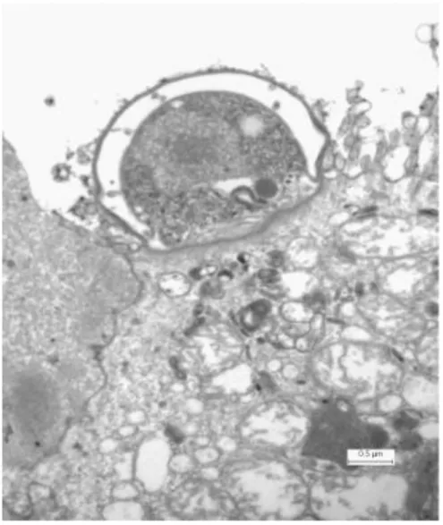 Figure 2. Transmission electron micrograph showing intracellular Cryptosporidium 
