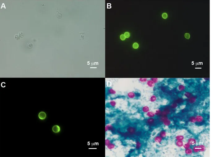 Figure  4.  Microscopic  observation  of  oocyts  of  Cryptosporidium.  (A)  Differential 
