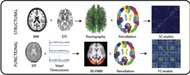 Figure 3 Pour créer un réseau de connectivité structurelle (SC), des données IRM et DTI (imagerie en tenseur de diffusion)  sont nécessaires permettant de réaliser des analyses en tractographie pour étudier les liens structurels entre différentes  régions 