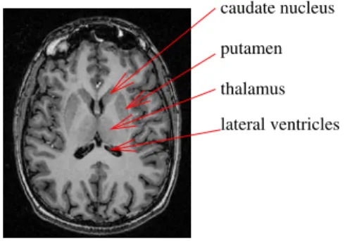Fig. 1. An example of a slice of a 3D MRI of the brain, with a few anatomical structures