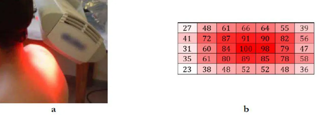 Figure 18 : Illumination de la peau par un panneau de LED (Aktilite CL16)(a) et distribution des  puissances (mW.cm-2) sur la zone illuminée (7 x 5 cm) (b)[120] 