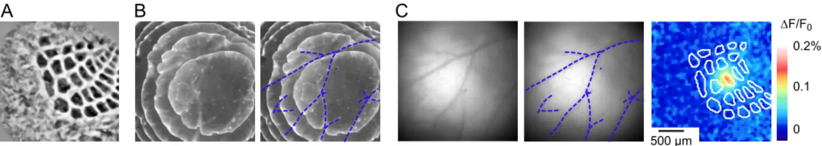 Figure 2: Alignment of the barrel map with VSDI data using the superficial blood vessels as blueprints.