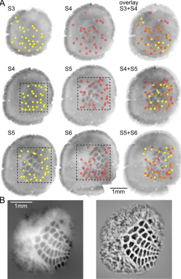 Figure 3: Registration of histological slices and subsequent barrel map reconstruction.
