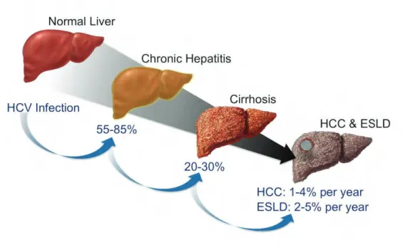 Figure 2 : Evolution de l’infection par le HCV 