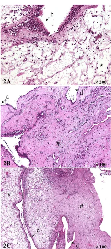 Figure 5 : Morphologie des 3 types de polypes issus de la classification (×100 and ×200)    