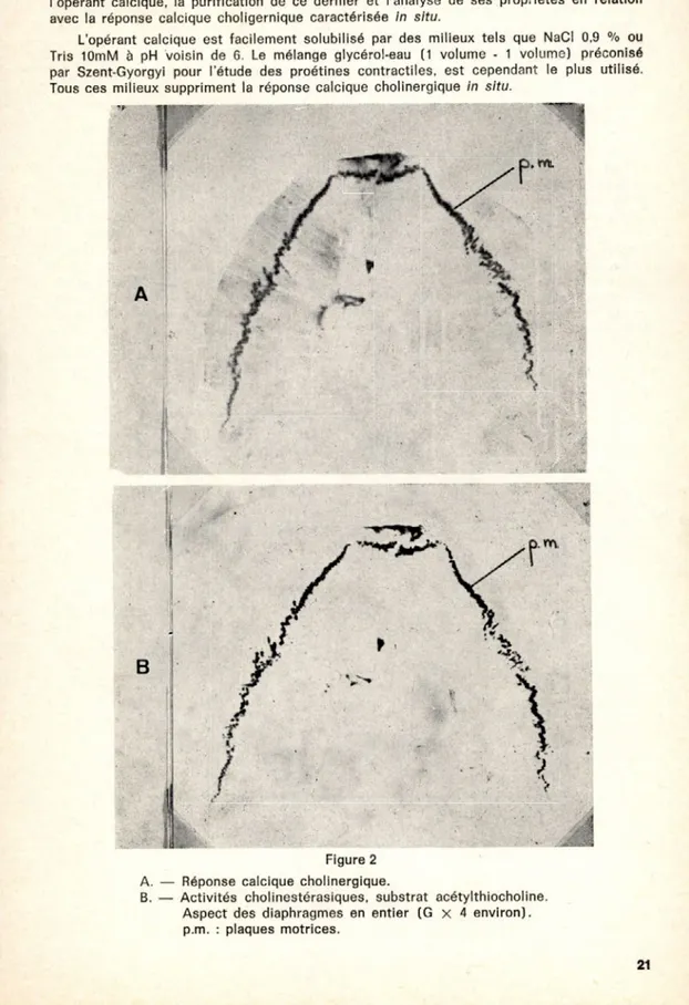 Figure  2 A.  —   Réponse  calcique  cholinergique.