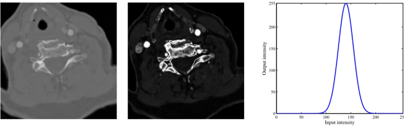 Figure 1: Vessel intensity enhancement : initial image (left), enhanced image (center), gaussian look-up table (right)